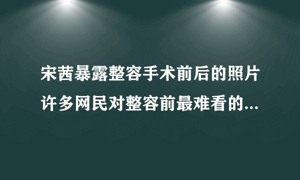 宋茜暴露整容手术前后的照片许多网民对整容前最难看的照片感到好奇
