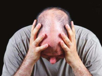 艾福杰尼谢广坤同款秃头，秃头对颜值的影响有多大？