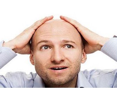 艾福杰尼谢广坤同款秃头，秃头对颜值的影响有多大？