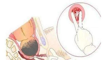 男医生单独对女患者肛检被约谈,医生的行为是正常治疗吗?