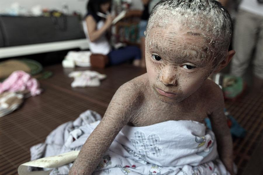 树皮娃娃的事件详情