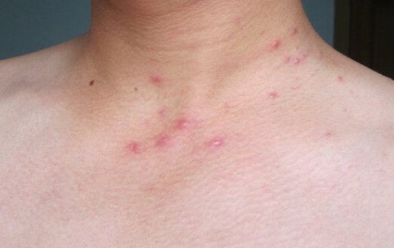 我国艾滋病的流行现正处于什么期