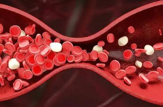 西安女子10年前腿受冻反复湿疹却是血管炎,这种病该如何治疗?