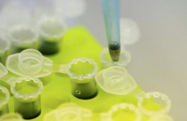 埃博拉可比新冠病毒猛太多了，为何埃博拉病毒有一个别称：内脏绞肉机？