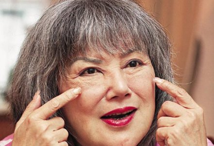 邵音音为什么脸这样