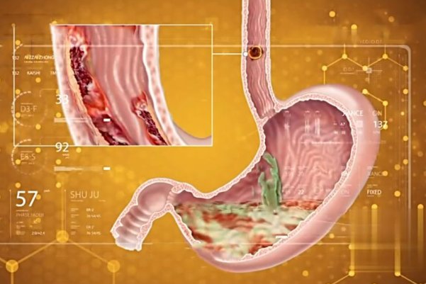 人体的消化器官怎么画