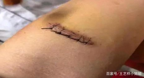 在街头看到持刀劫匪，你敢不敢上去见义勇为？